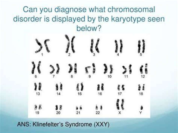By analyzing the karyotype what chromosomal disorder is present?