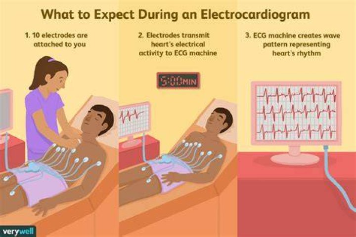 Do you need to fast before an electrocardiogram?