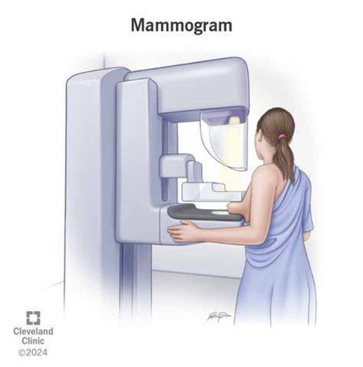 For mammographic x-ray imaging?