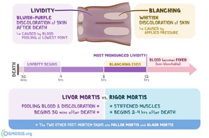 Is it livor mortis or rigor mortis?