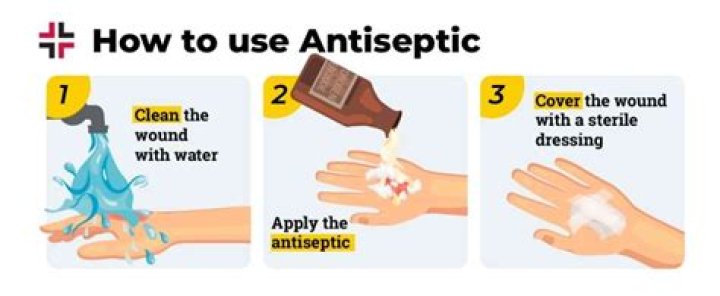 Should you use antiseptic on cuts?