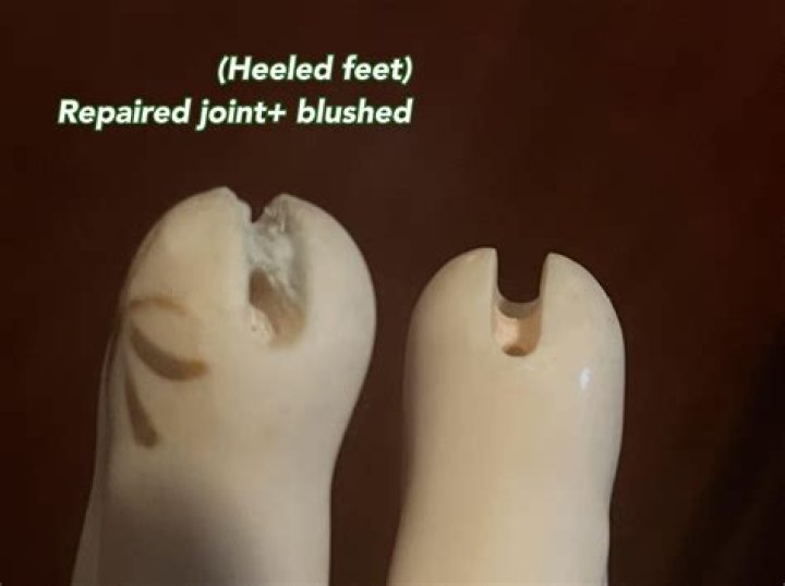 What are bjd recasts bad?