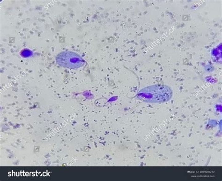 Which of the following is a flagellated protozoan?